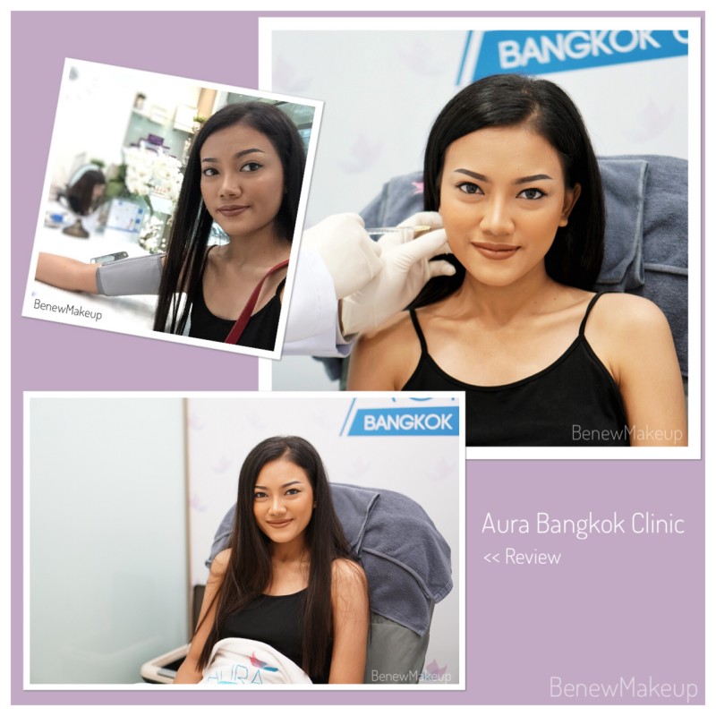  ǩմ⺷͡ Ѻٻ˹ ⺷͡˹ Botox Neuronox Botox Botulax  Aurabangkokclinic BanewMakeup Review BenewReview ⺷͡ ⺷͡ ⺷͡Ŵ ⺷͡˹ ⺷͡Ѻٻ˹ ReviewBotox ˹  VShape ˹ Ŵ ˭ ⺷͡ҤҶ١