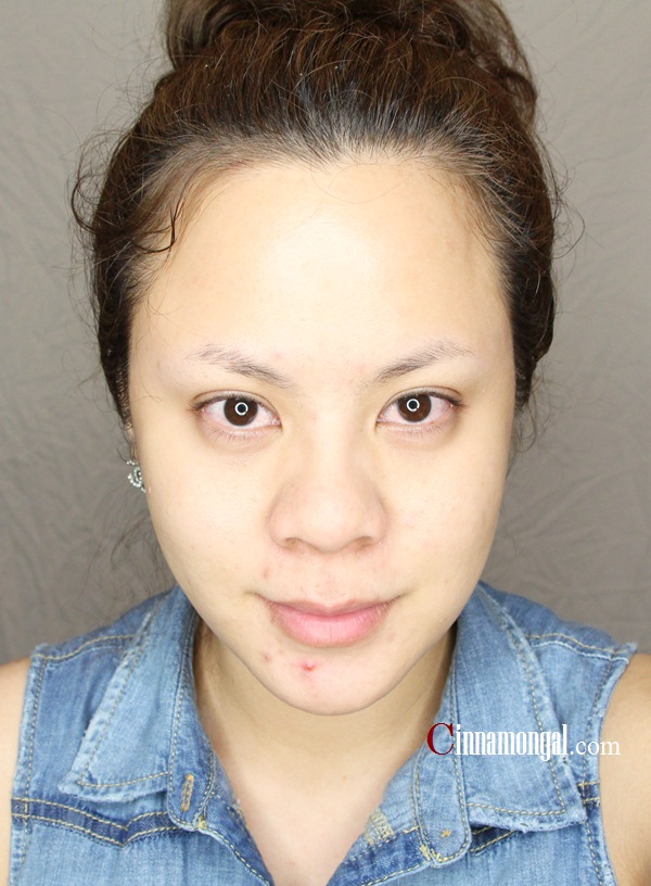 SkincareTest & RW: คุยเรื่องสิว และ LA ROCHE-POSAY EFFACLAR DUO ลด