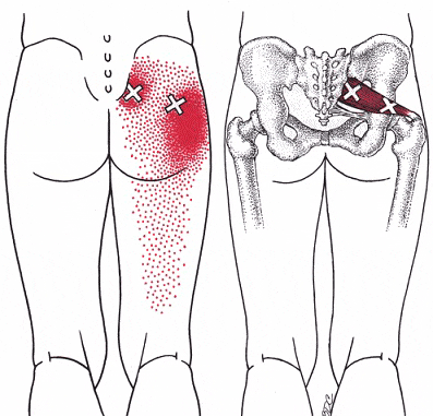 https://resiliencerxpt.com/blog/piriformis-syndrome-a-pain-in-the-butt/