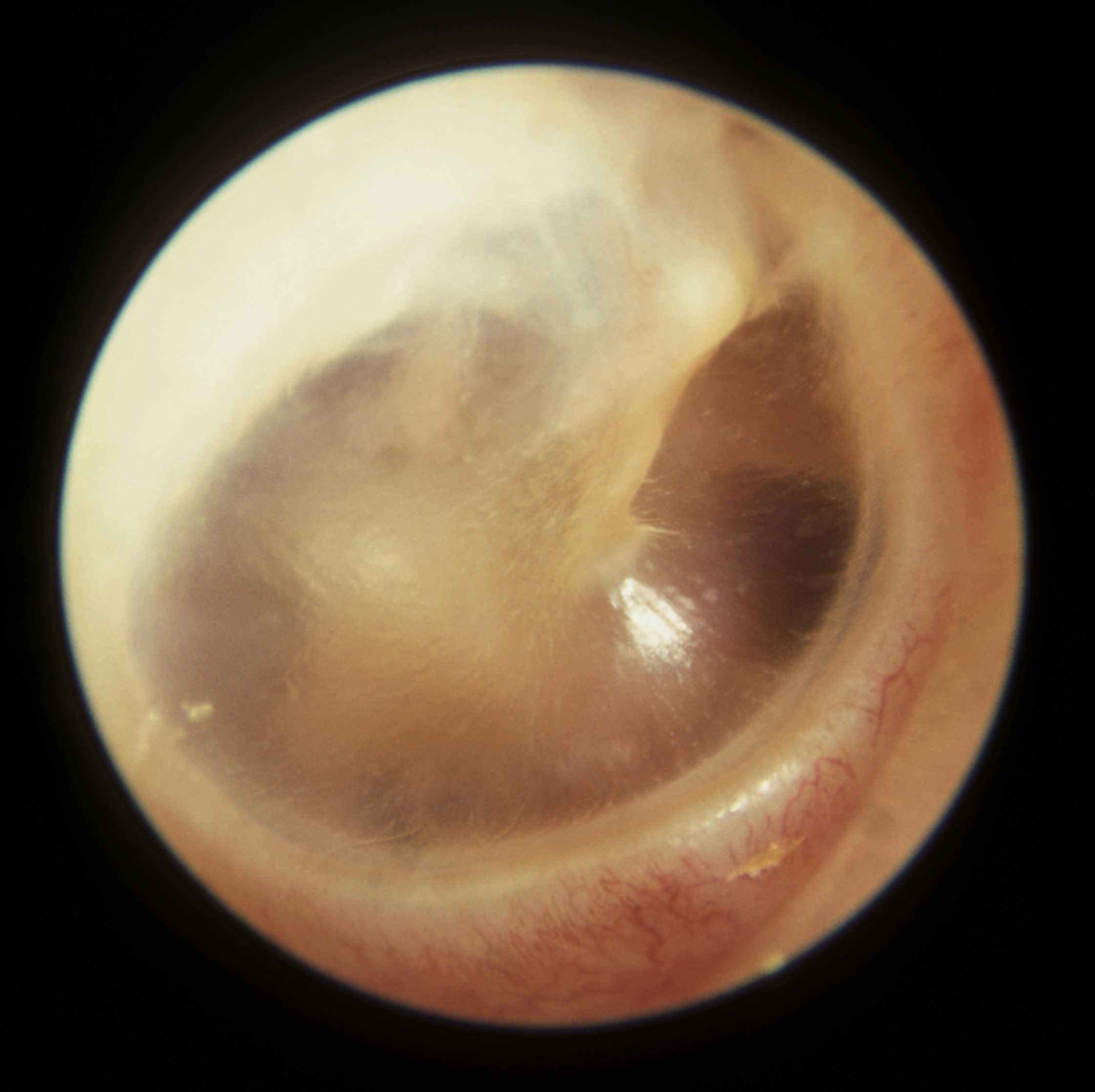 BlogGang.com : : Gibpiko : Anatomy of the ear