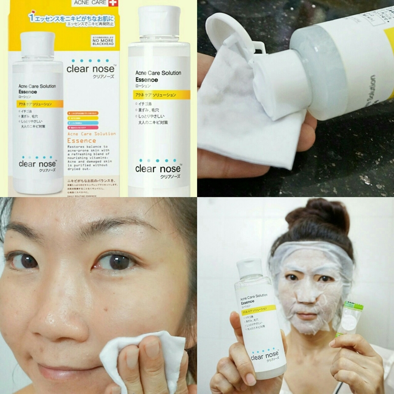 clear nose acne care solution essence