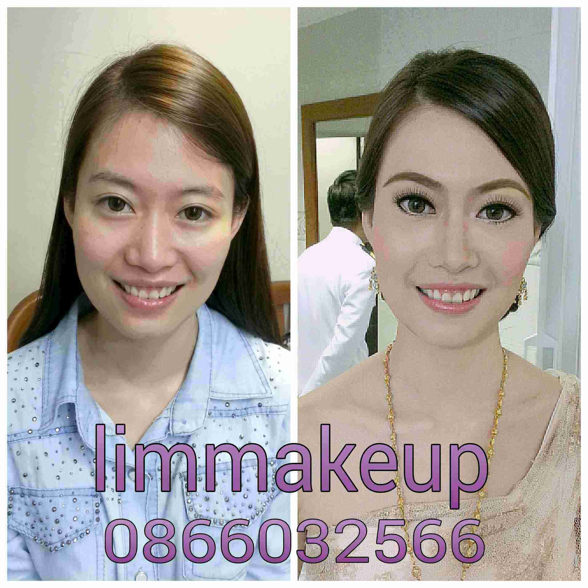 My Image 30