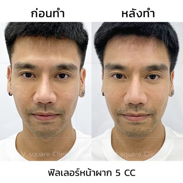 My Image 5