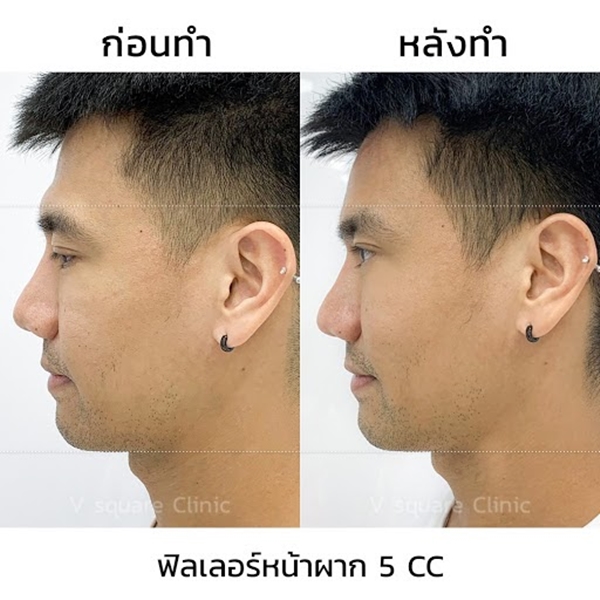 My Image 9