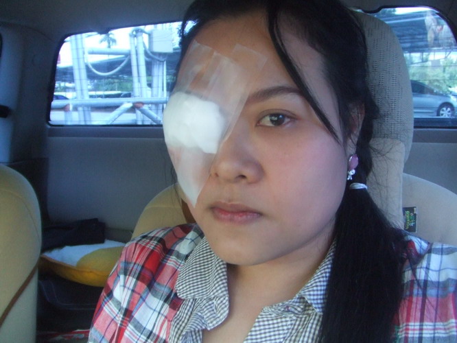 เมื่อตานาง (พญา) เป็นฝี : อาการ การรักษา และการป้องกัน