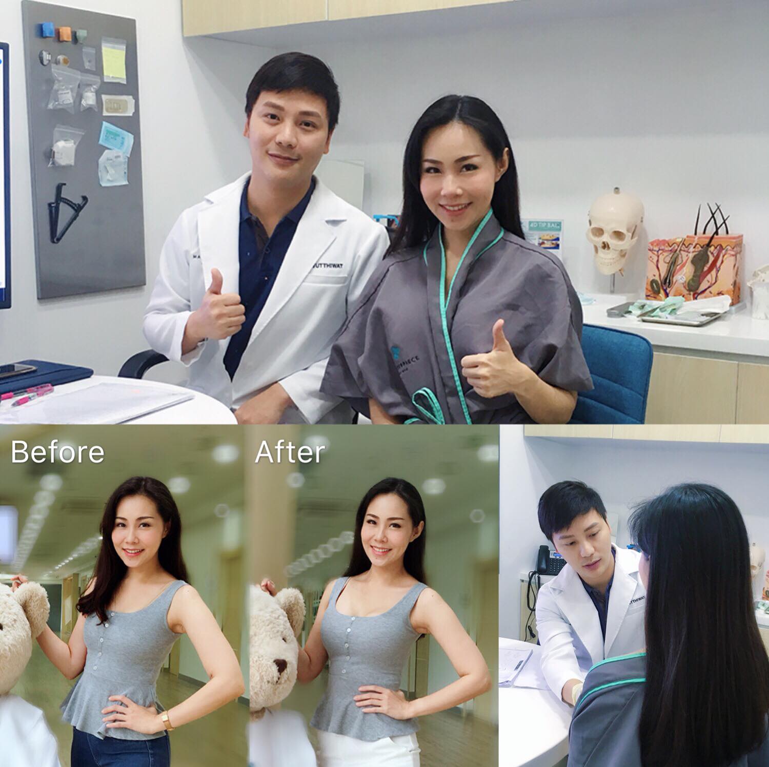 ⤹,ԡ,motiva,sebbin,barbie,,´,before,after,plastic,sugery,Review, ,,Masterpiece,Hospital ,ի,˹͡,clinic,⤹,mentor, س,,350cc,MTP,¡˹͡,¡,ӹ,ӹ,֡ҿ,դ,»ʹ,breast,augmentation, ӹ,˹͡,Ҥ,,˹,ҵѴ,ҹ,¡,,