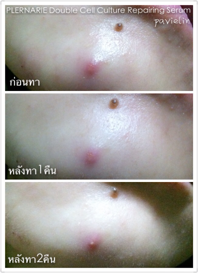   źͧҧ ͧ ºº 1. MILKY MAKE UP REMOVER LOTION 2. Double Cell Culture Repairing Serum PLERNARIE   Lab ҡ Intertek (Lab ҵҰҹҡѧ) ҼԵѳاǷءǢͧԹջʹѹ ͼ˹ѧ ʹûͷ ä⹹ Դ秼˹ѧ  ׹͹ Ŵ Ŵ   ´ҧ