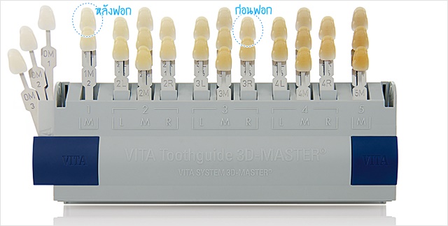 Cosmetic,Dentistry,Dental,Smart,Clinic,DentalSmartClinic, ,ѹ,,Cool Light,Cool,light,whitening,͡տѹ,,Թԡ,ѹ, 繷,乷,,9,The Nine,Rama9, ,͡ѹ,͡,տѹ,,ѹͧ,,ѹ,Ҵ,   ʺó,,ǹ,繼,ѹᾷ,Ϳѹ,Ǩ, ,,ѹҧ,ŷ,Blue,zoom,ͧ,,ͧ,µͧ,ͧ,ҹ, ǿѹ,տѹ,ش,Ѵѹ,٧,,ʧ, ١,Ǣ,˵,ѹ,,In-office,tooth,Laser,,ŷ,Home,bleaching, ,,  ʹ,,,,Veneer,ä˧͡,ѹ,ѹ,ͺѹ,,͹,ѧ,,, ,ʧ,Oral Care,Colgate,Sensitive,Pro-Relief,ҡ,,ҹ,Ҥ,Ҵ,˹, VITA,Toothguide,3D,MASTER,ӿѹ,Դͧҧ,ҧ,ѹ,Ըշ,ͺô,