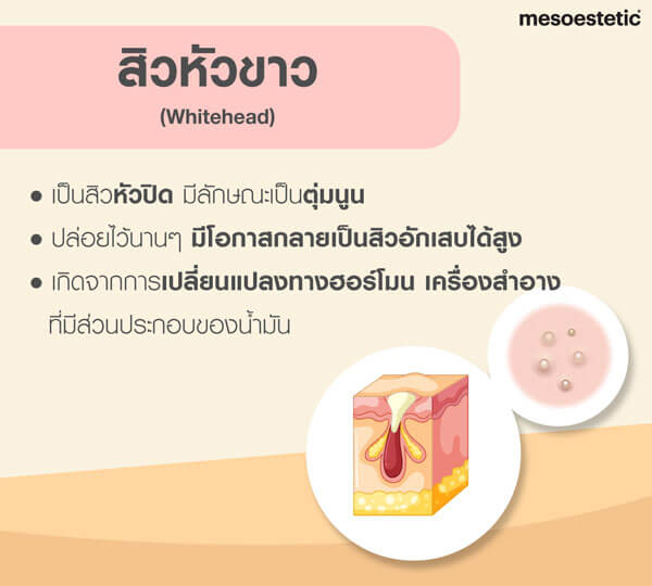 My Image 28