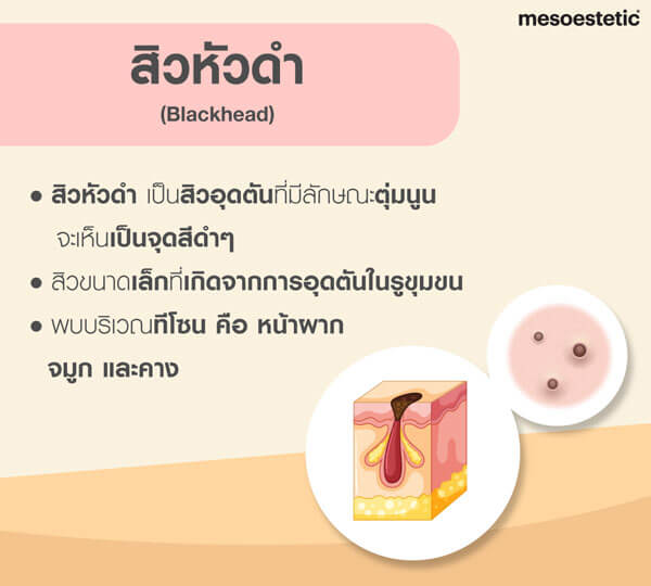 My Image 32