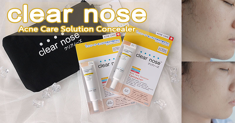 รีวิว Clear nose Acne Care Solution Concealer