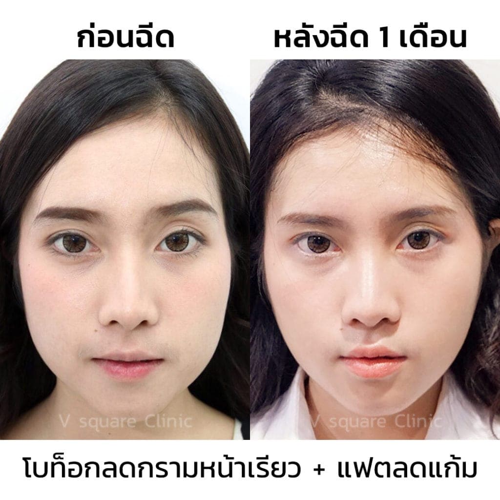 My Image 17