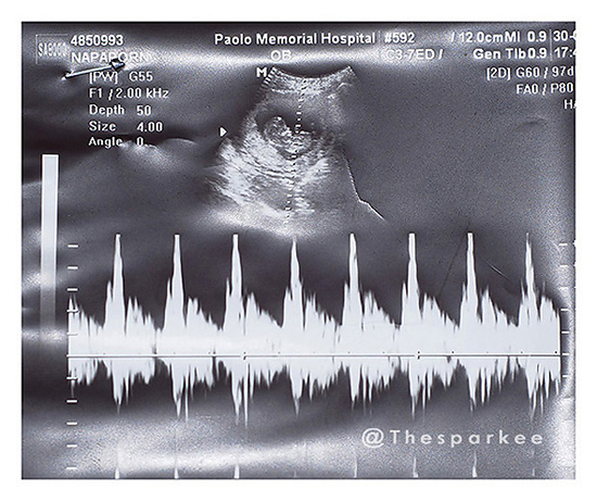 My Image 16