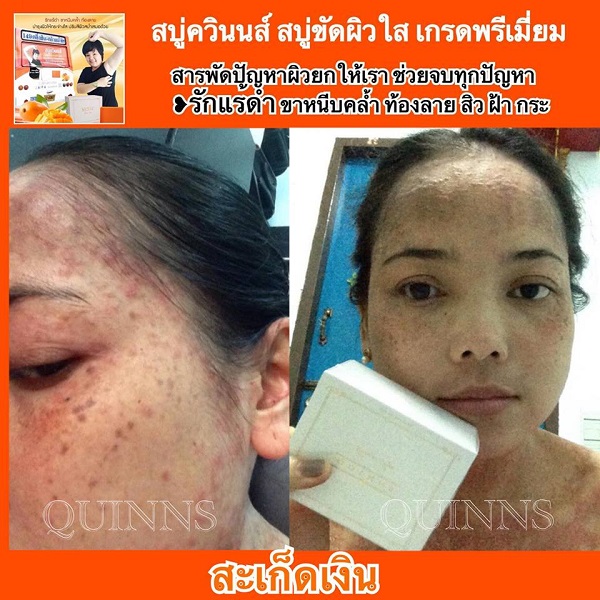 My Image 39